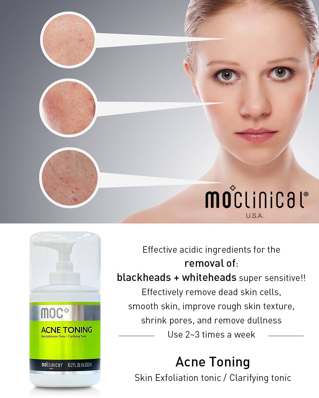 MO Clinical Acne Toning