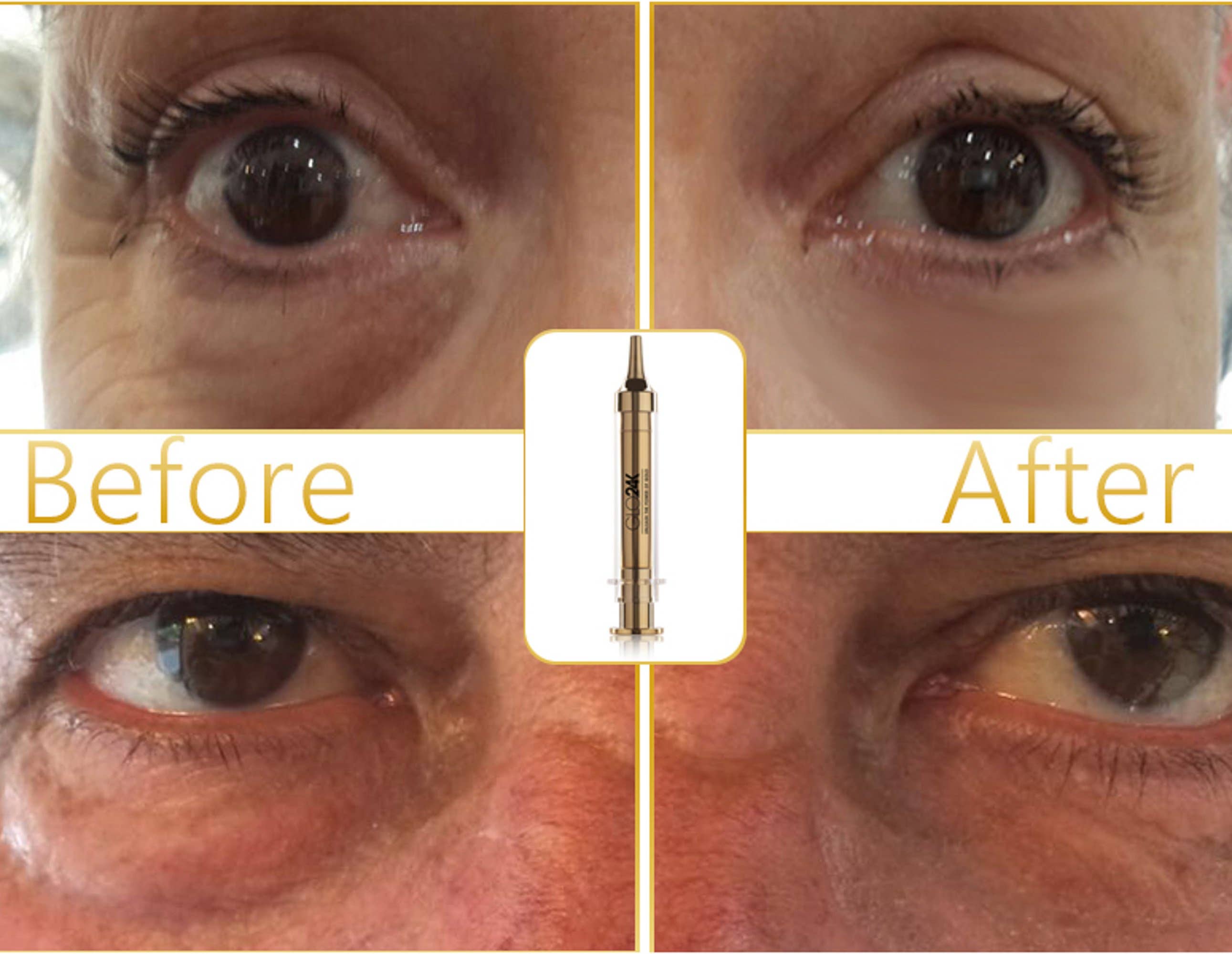 Express Non-Surgical Anti-Aging Facelift Cream with 24k Gold