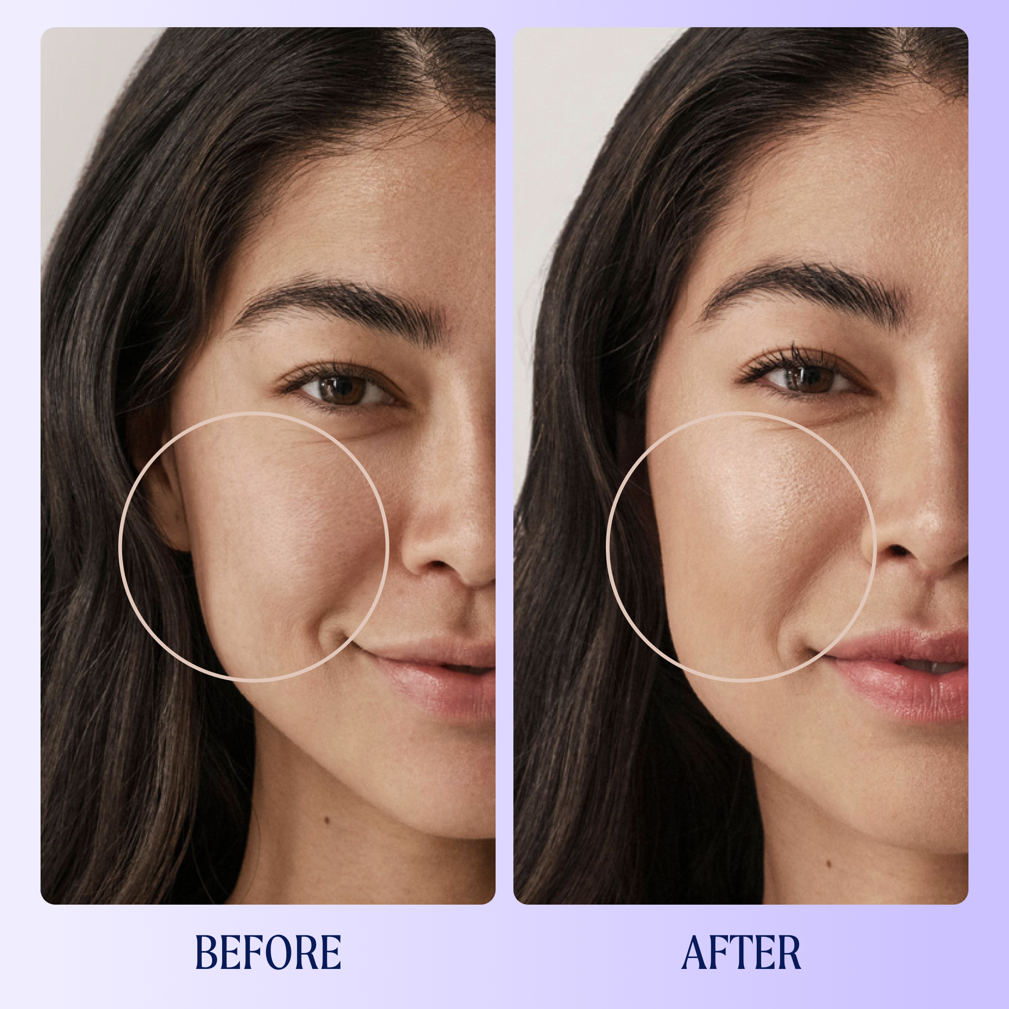 Self Reflect Probiotic Sunscreen Zinc Oxide SPF 32