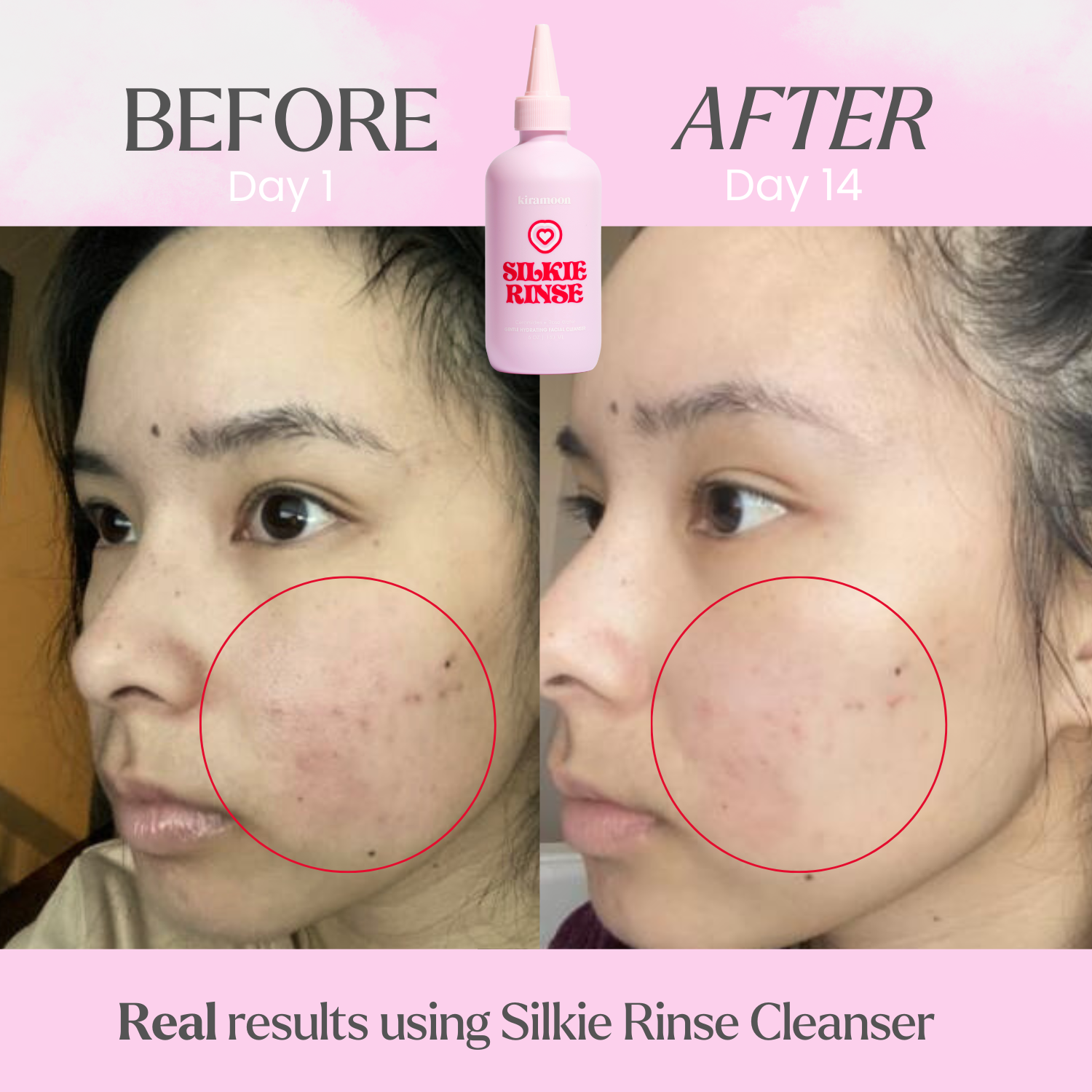 Silkie Rinse Gentle Hydrating Ceramide Cleanser