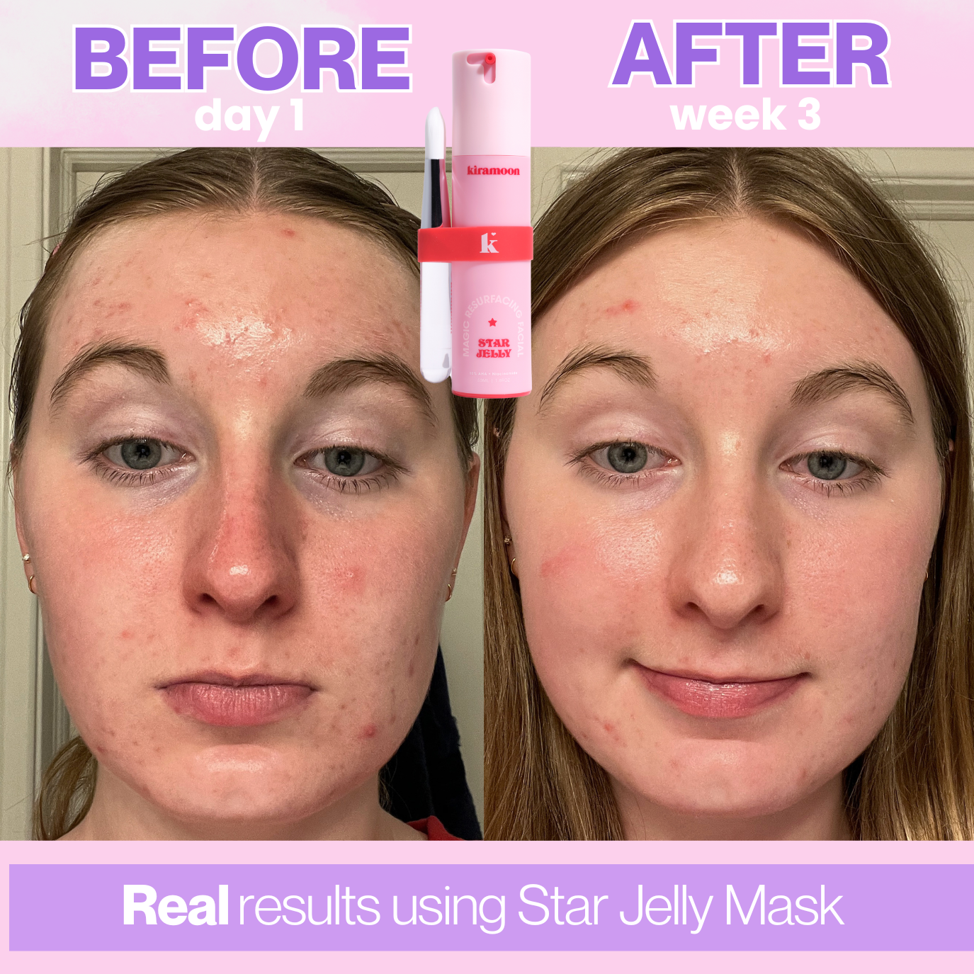Star Jelly 10% AHA Resurfacing Facial Mask