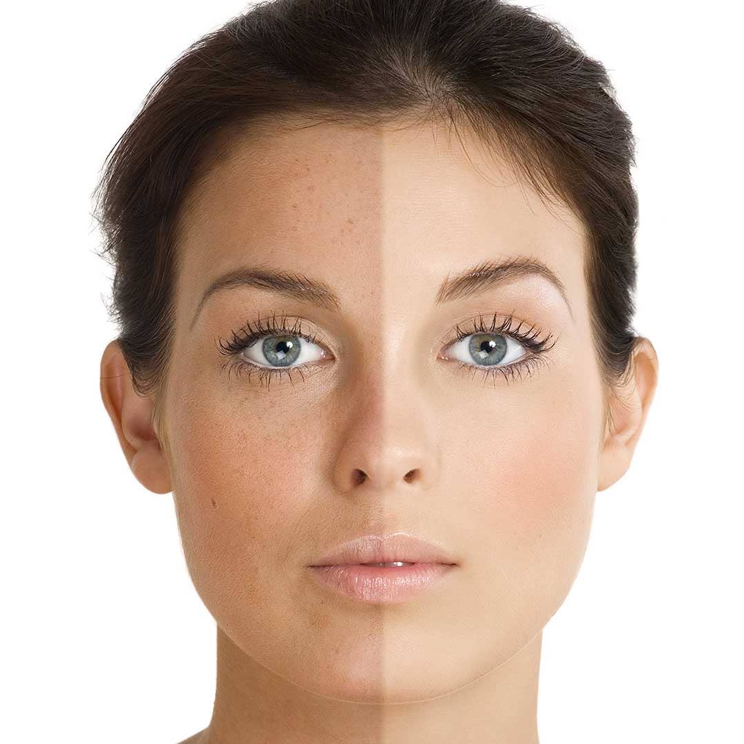 Magnolia Orchid α-Arbutin Advanced Radiance Concentrate